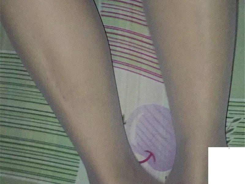 一場激烈的肉搏開始了 (15P)