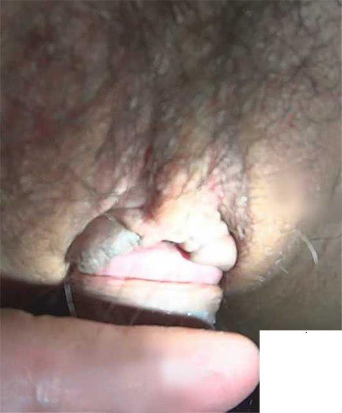 入小穴 (11P)
